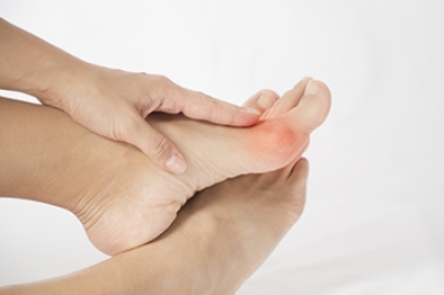 Bunion Formation and Treatment