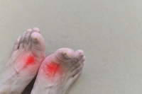 Painful Gout Is a Form of Arthritis